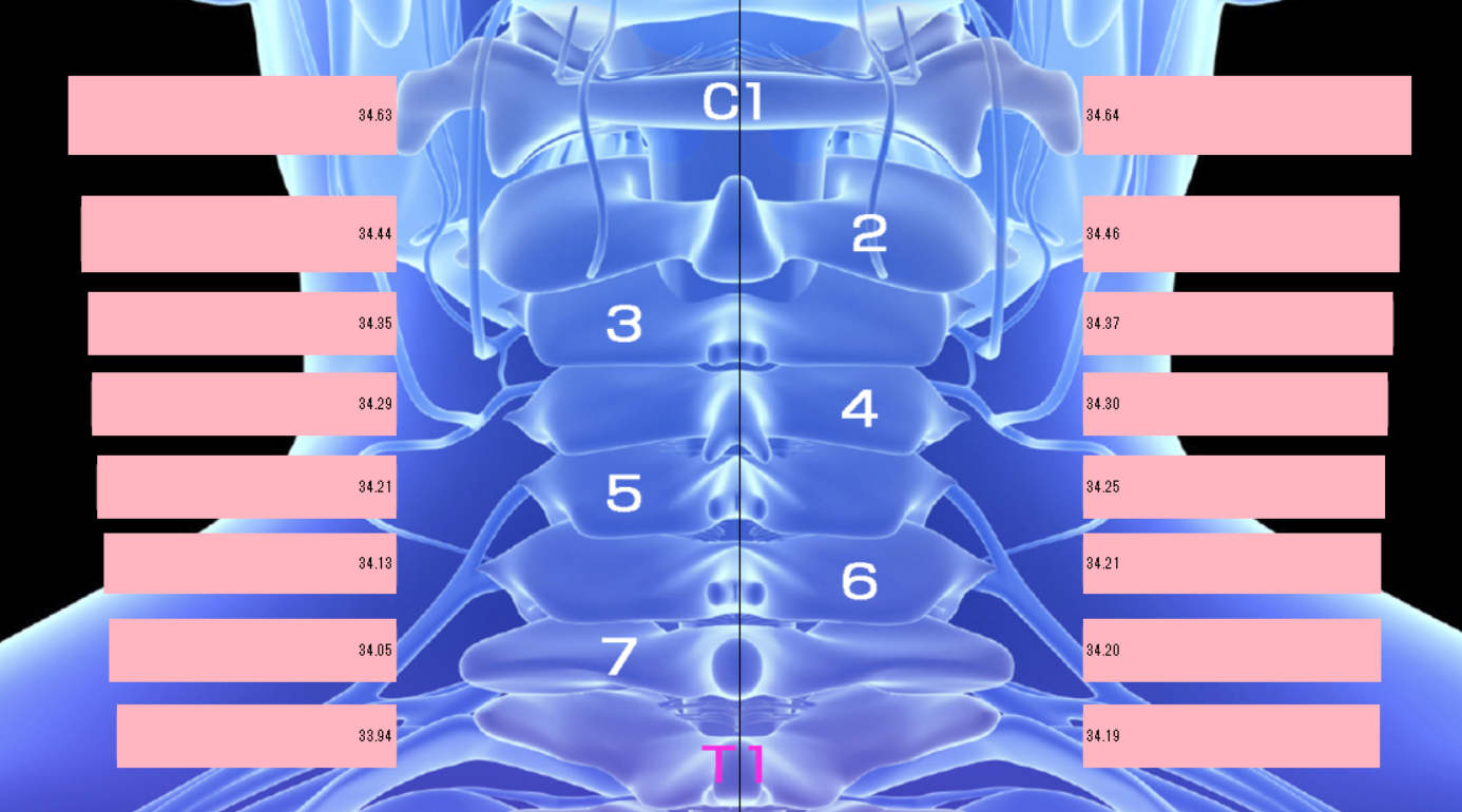 施術後 ThermoLab