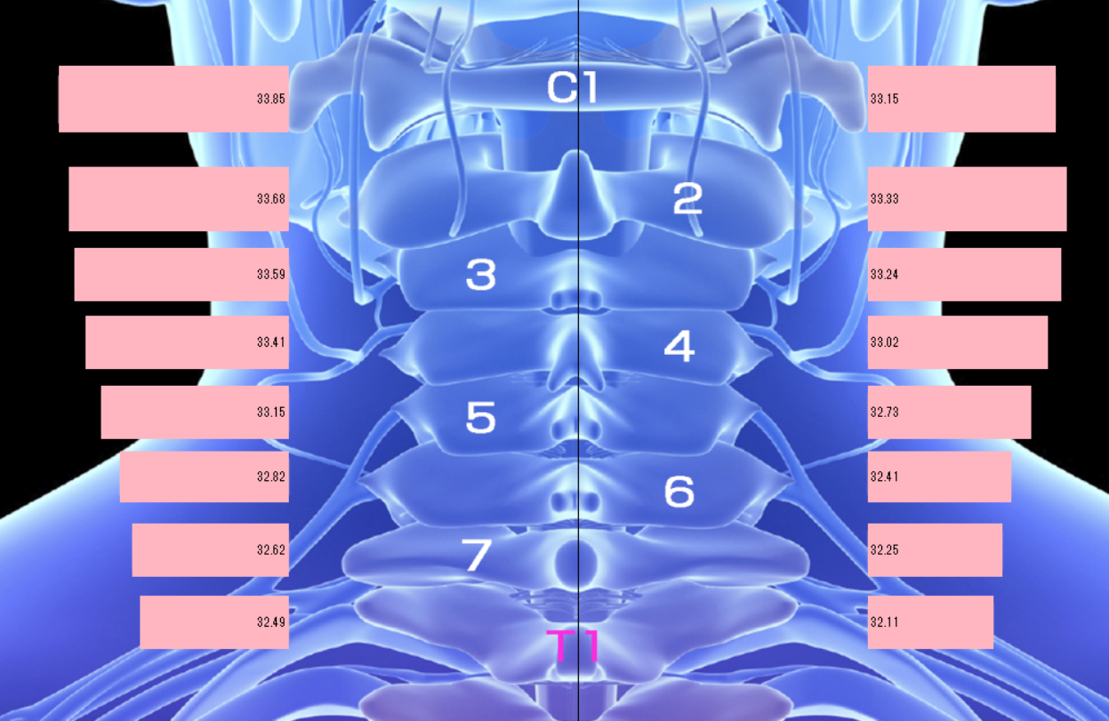 施術前 ThermoLab